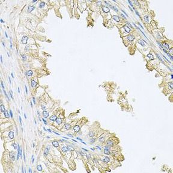 PPP3R1 Antibody