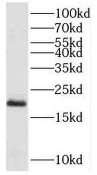 PPP3R2 Antibody