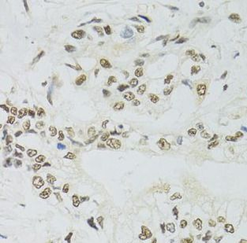PPP4C Antibody