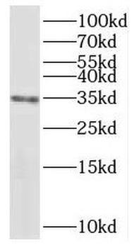 PPP6C Antibody