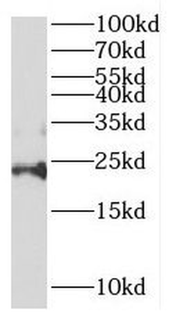 DESI2 Antibody