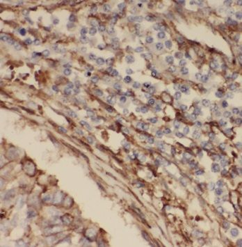 DESI2 Antibody