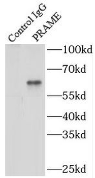 PRAME Antibody