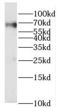 PRCC Rabbit Polyclonal Antibody