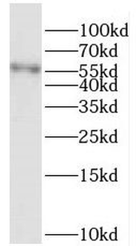 PRCP Antibody