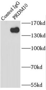 PRDM10 Antibody
