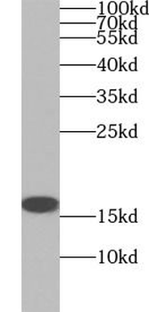 TTR Mouse Monoclonal Antibody