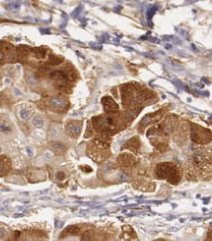 TTR Mouse Monoclonal Antibody