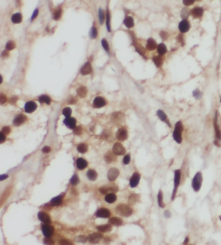 PREB Antibody