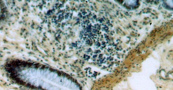 PRICKLE3 Antibody