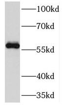 PRIM2 Rabbit Polyclonal Antibody