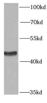 PRKAR1A Antibody