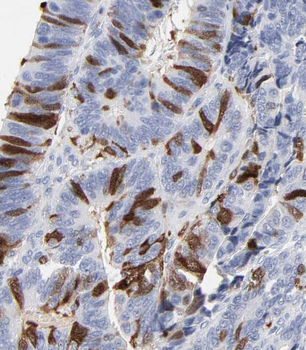 PRKCSH Antibody