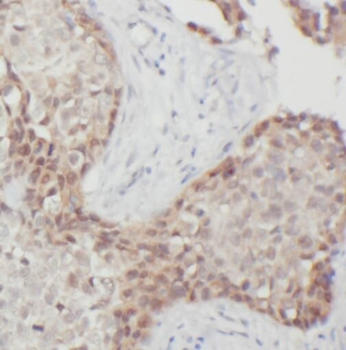 PRMT6 Antibody