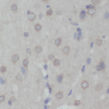 PRMT8 Antibody