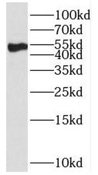 PROC Rabbit Polyclonal Antibody