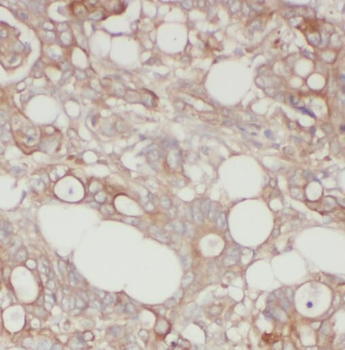 PFN1 Antibody