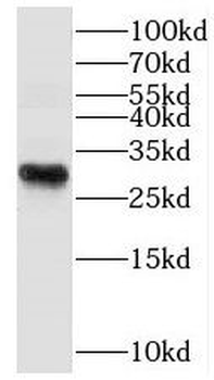 PLPBP Rabbit Polyclonal Antibody
