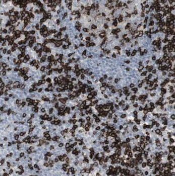 PTMA Rabbit Polyclonal Antibody