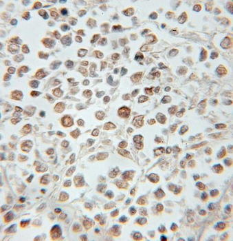PROX1 Antibody