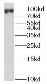 PROX1 Rabbit Polyclonal Antibody
