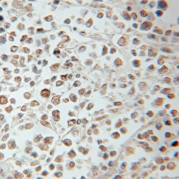 PROX1 Rabbit Polyclonal Antibody