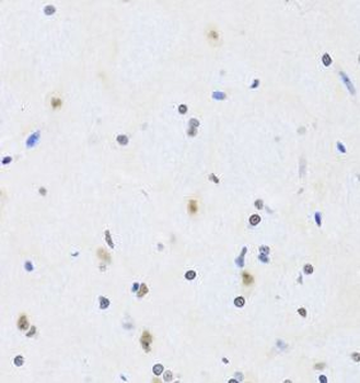 PRPF19 Antibody