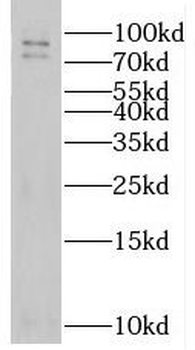PRPF3 Antibody