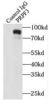 PRPF3 Antibody