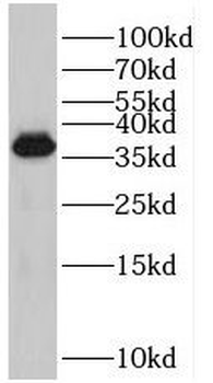 PRPF38A Antibody