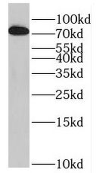 PRPF39 Antibody