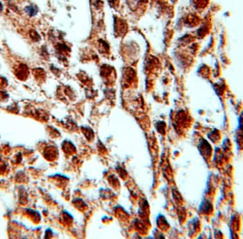 PRPF4 Antibody