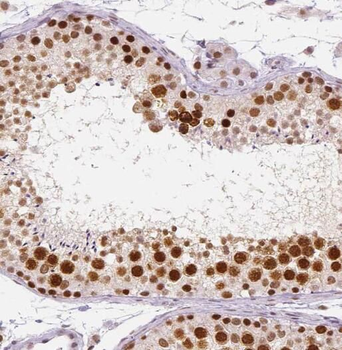 PRPF6 Antibody