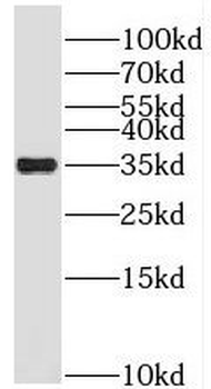 PRPS1 Antibody
