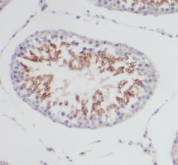 PRPS1 Antibody