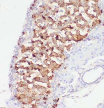 PRPSAP2 Antibody