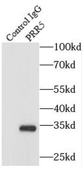 PRR5 Antibody