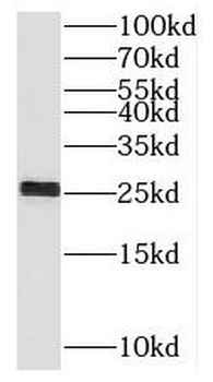 PRTFDC1 Antibody