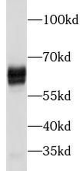 PSAP Rabbit Polyclonal Antibody