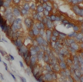 PSAP Rabbit Polyclonal Antibody