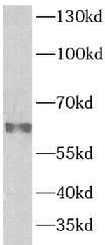 PSAP Rabbit Polyclonal Antibody