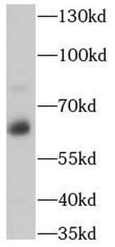 PSAP Rabbit Polyclonal Antibody