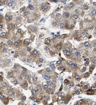 PSAP Rabbit Polyclonal Antibody