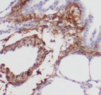 PSAT1 Antibody