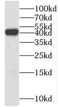PSAT1 Antibody