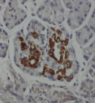 PSAT1 Antibody