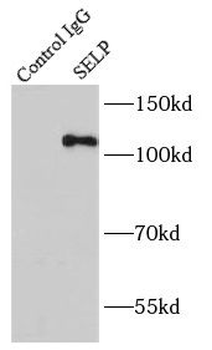SELP Mouse Monoclonal Antibody