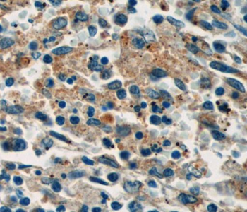 SELP Mouse Monoclonal Antibody