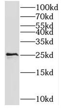 TAP2 Antibody
