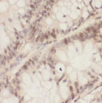 PSMA1 Antibody